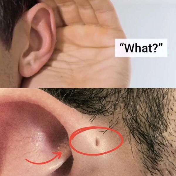 Ear